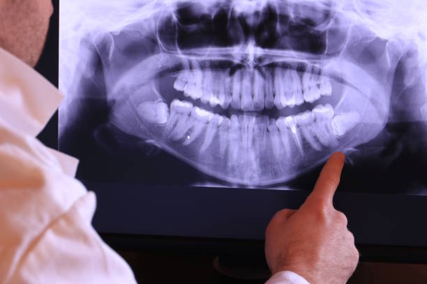 Best Emergency Broken Tooth Repair in Lynbrook, NY
